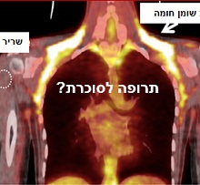 התרופה האמיתית לסוכרת