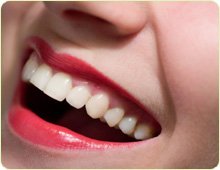 הלבנת שיניים באמצעות ציפוי חרסינה