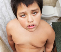 השמנת יתר בקרב ילדים - מגיפת העתיד
